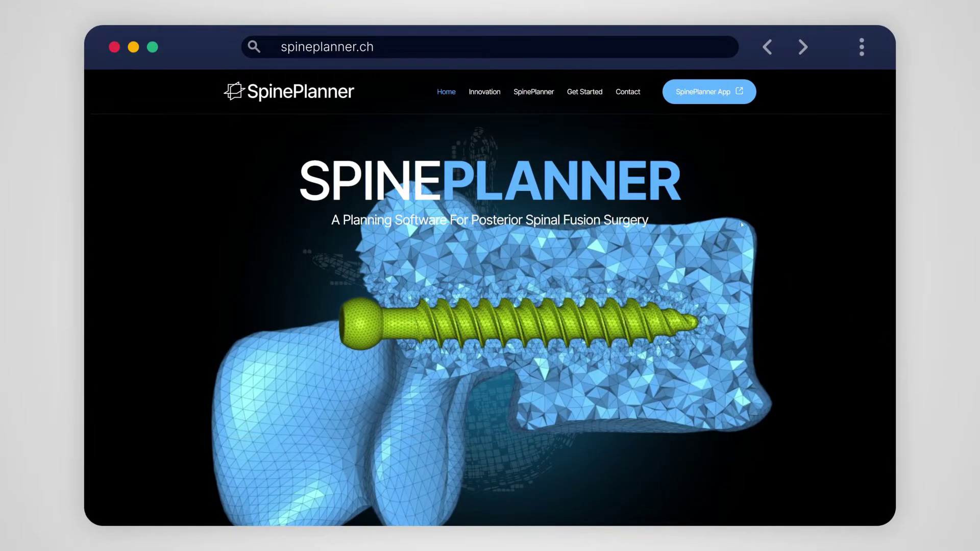 SpinePlanner CT scan upload and analysis interface for spinal surgery planning